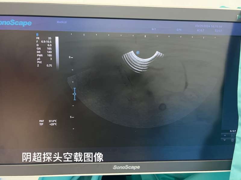 開立 SonoScape B超探頭問題如下：1.高頻探頭老化，圖像顯示不清2.陰超探頭鼓包，手按壓鼓包處，黑影會隨之移動變化