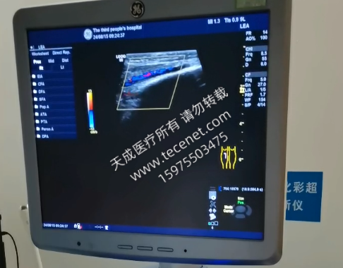 彩超型號LOGIQ S8,醫(yī)生反應做病人時切換工作模式經常不生效