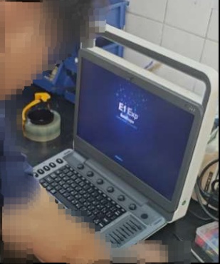 開立B超機(jī)，腹部探頭壞了，接觸不良,型號(hào)E1 EXP