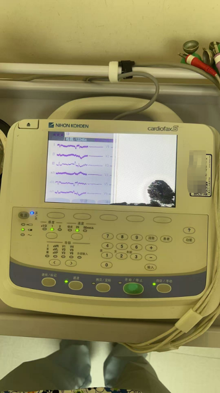维修NIHON KOHDEN 日本光电cardiofaxS 心电图机ECG-2250 显示屏幕故障，心电波形有干扰。