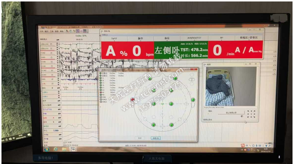 维修施诺曼 多导睡眠记录仪 SOMNOscreenplusPSG+ 更换头盒接口,同时更换主机脑电接口。
