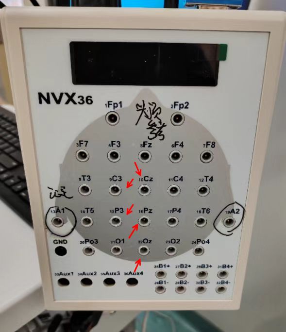 NVX36脑电图机故障