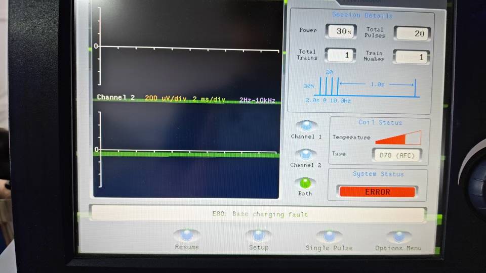 神经磁剌激器RAPID2 S/N:797，无法启动治疗，报错E80