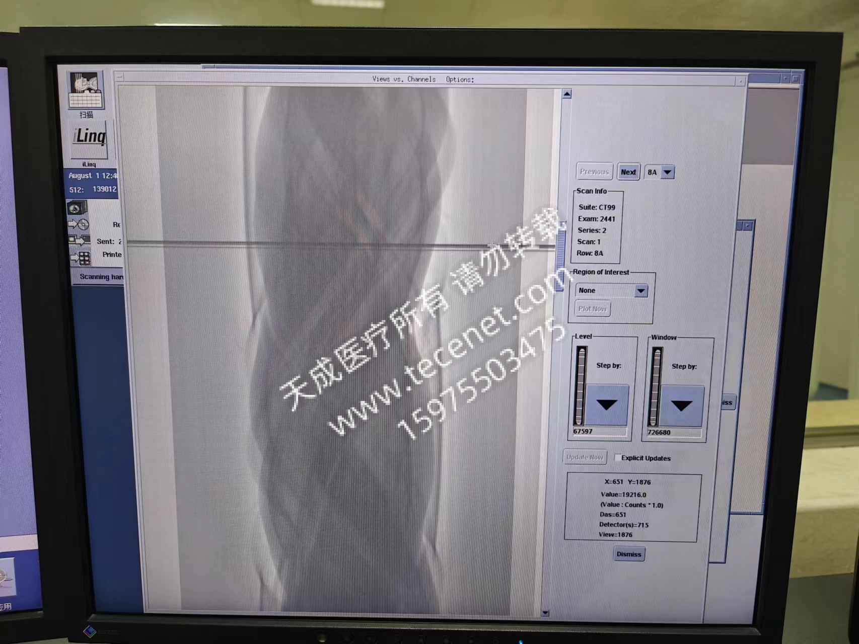維修GE CT BrightspeedElite16 圖像偶有偽影