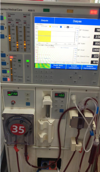 维修费森尤斯 血透机 4008S 泵头*1
流量泵马达套装*2
浓缩液泵*1