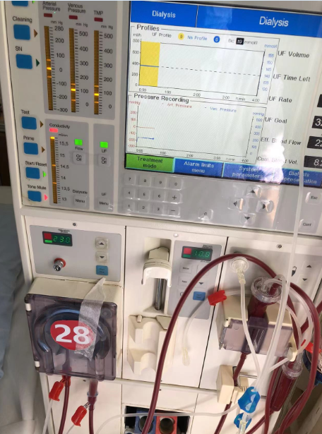 维修费森尤斯 血滤机 4008S 除气泵整套