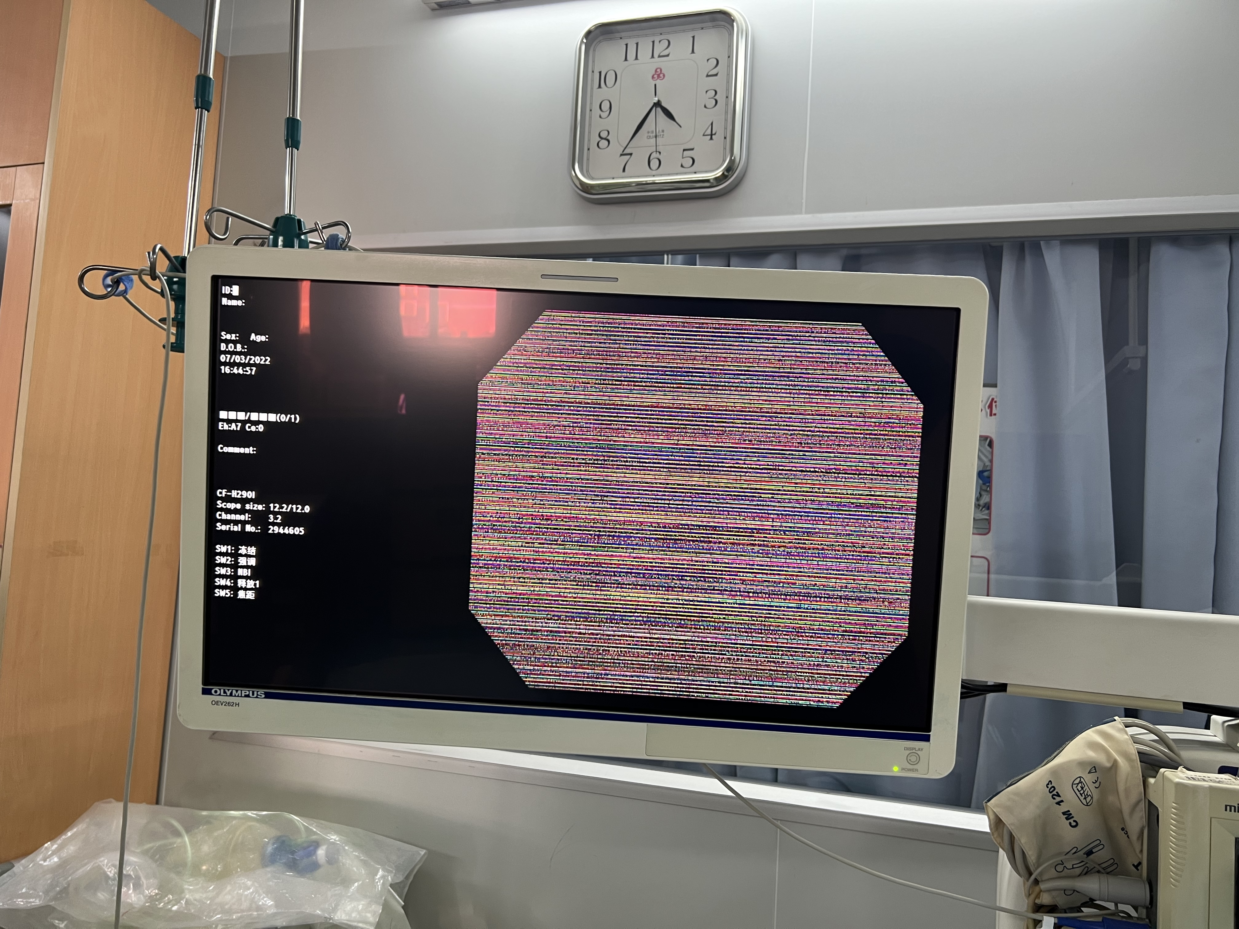 维修奥林巴斯 电子肠镜 CF－H291I 漏水，导光束老化，CCD失图像阴影。 