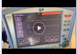 维修康尔福盛 呼吸机 VELA 开机报呼吸机故障