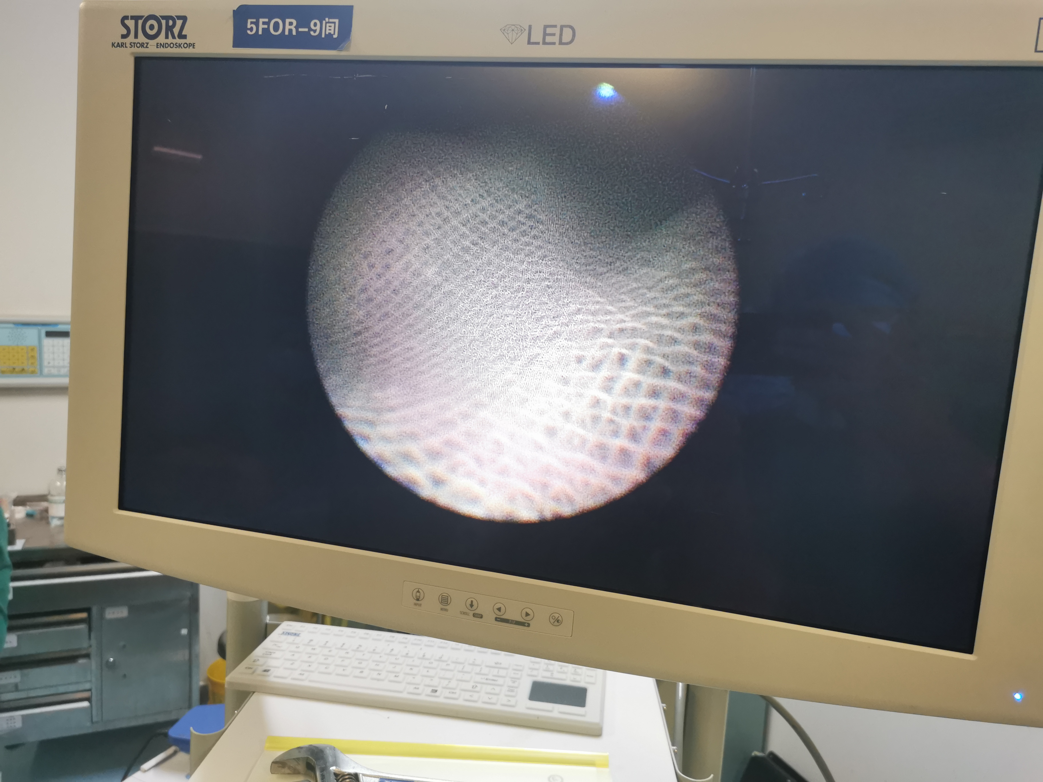 维修Wolf Wolf镜 R.WOLF 更换管道和光纤 、物镜组和像束 、清理及调整光学系统 、调校目镜组 、重新校对图像 、密封内窥镜