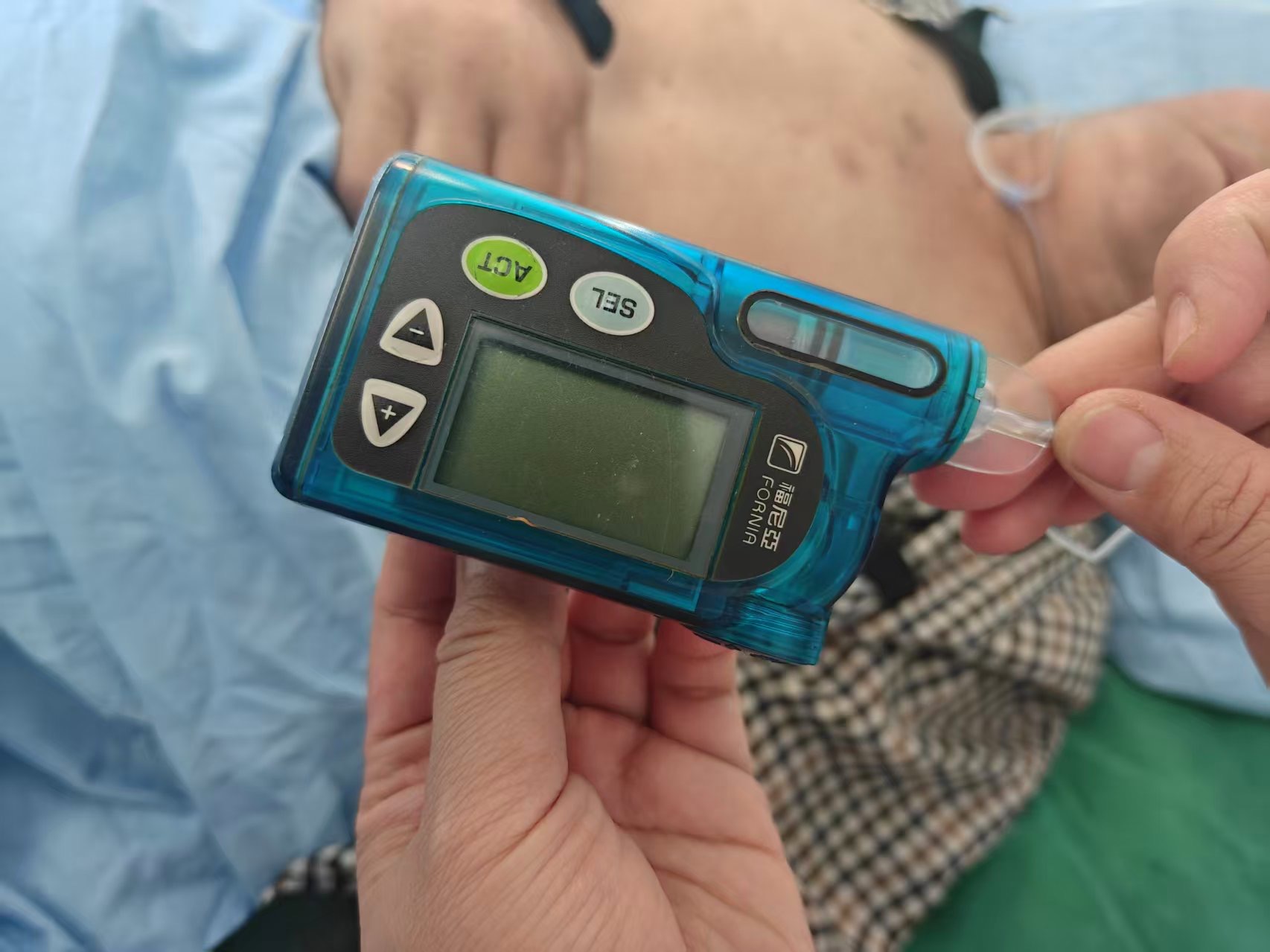 维修富尼亚的胰岛素泵