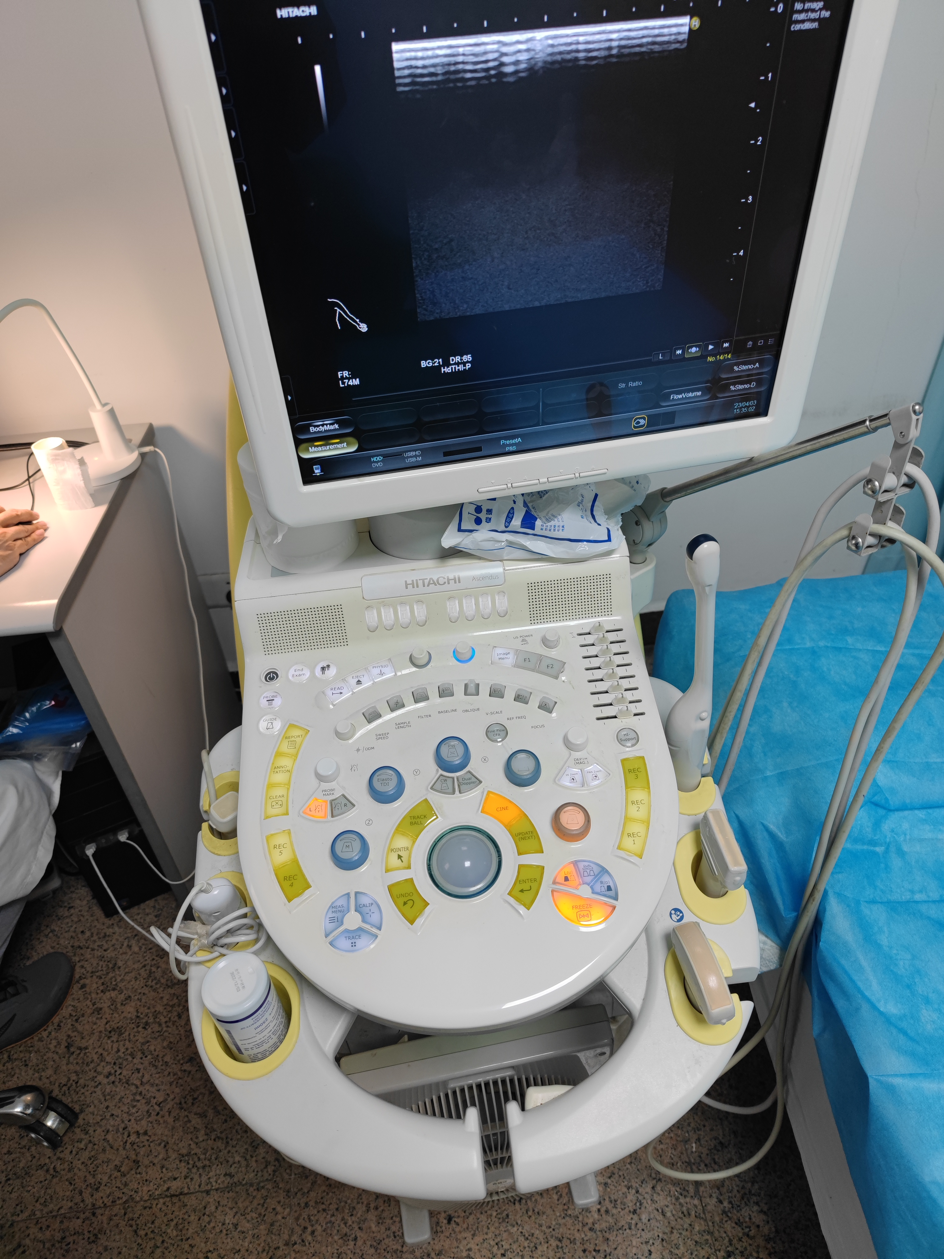 维修日本日立 数字化彩色超声波诊断装置 HIVISIONAscendus CELL板