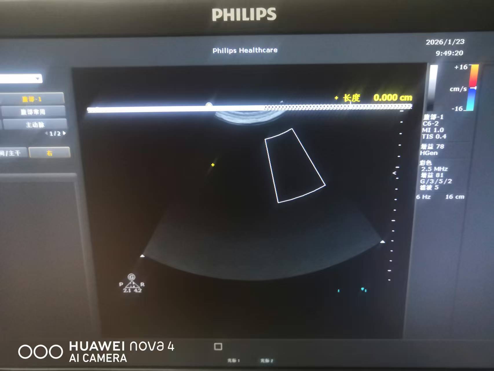 维修飞利浦HD8彩超自动弹出无关字符，机器无法操作