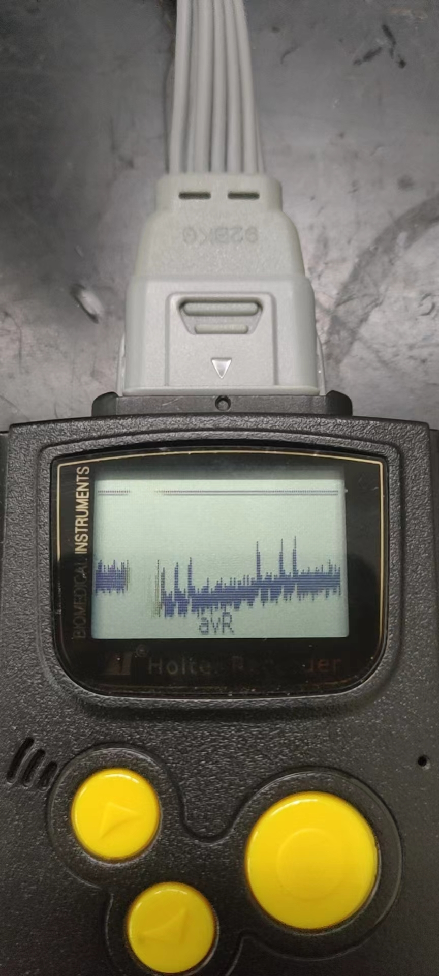 維修深圳博英 動態(tài)心電圖工作站記錄器 BI9800 導聯(lián)線老化破損 