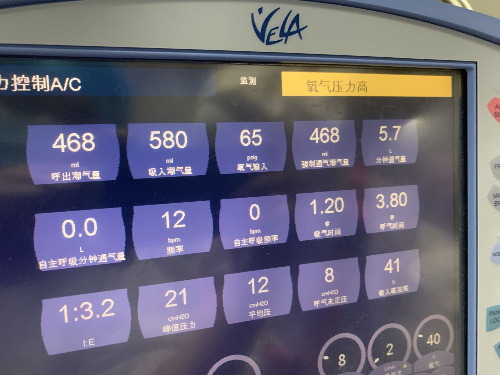 维修康尔福盛 呼吸机 VELA 调压阀