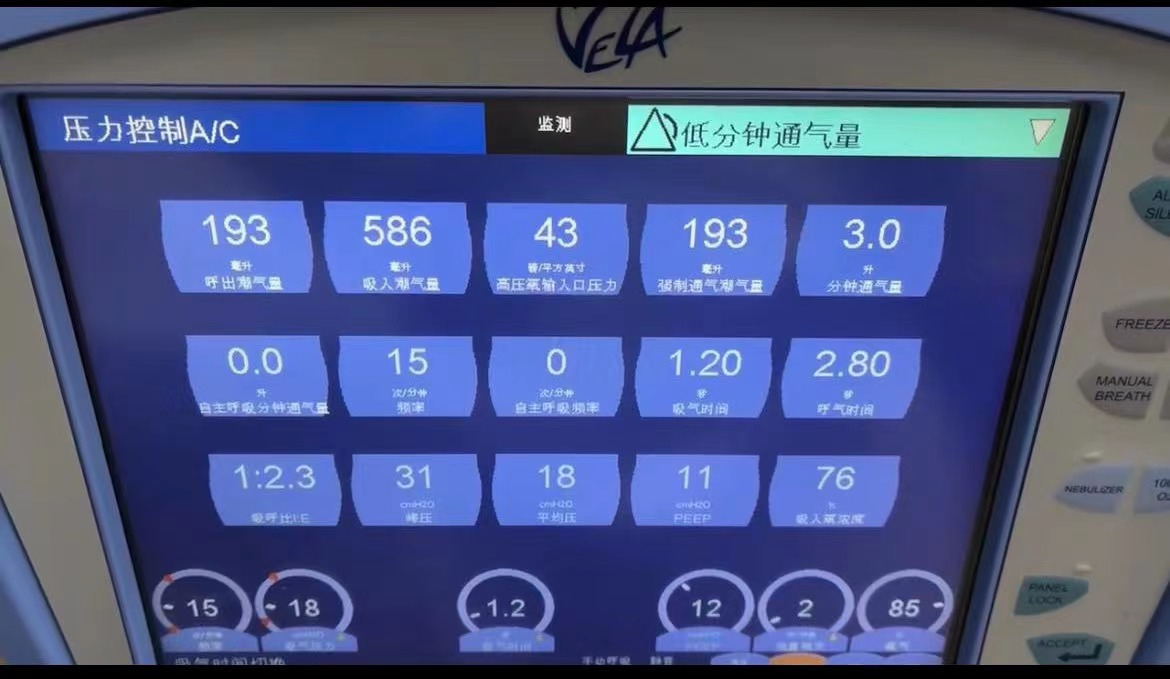 维修康尔福盛 呼吸机 VELA 主板传感器故障 