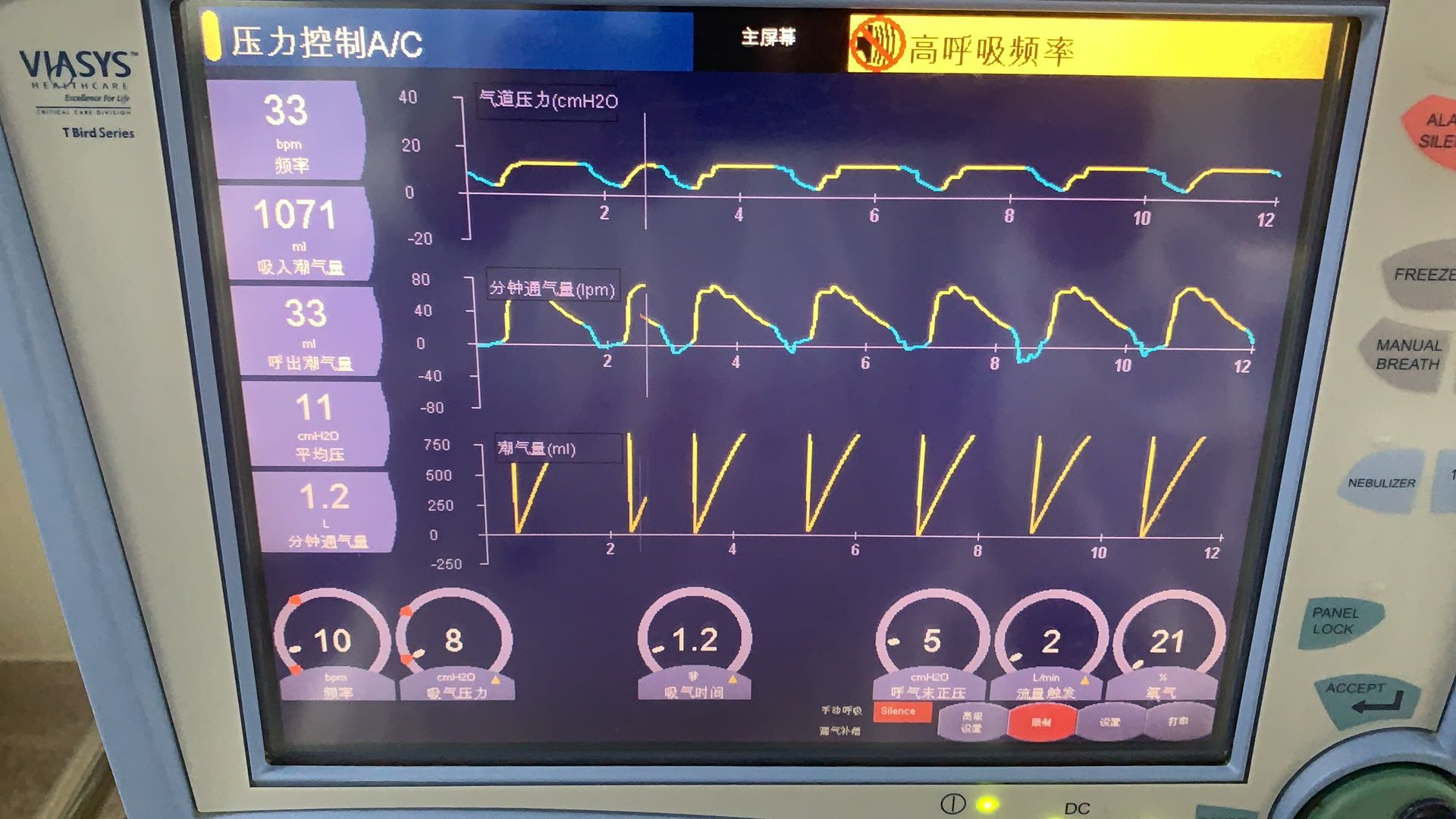 维修康尔福盛 呼吸机 VELA 主板维修
