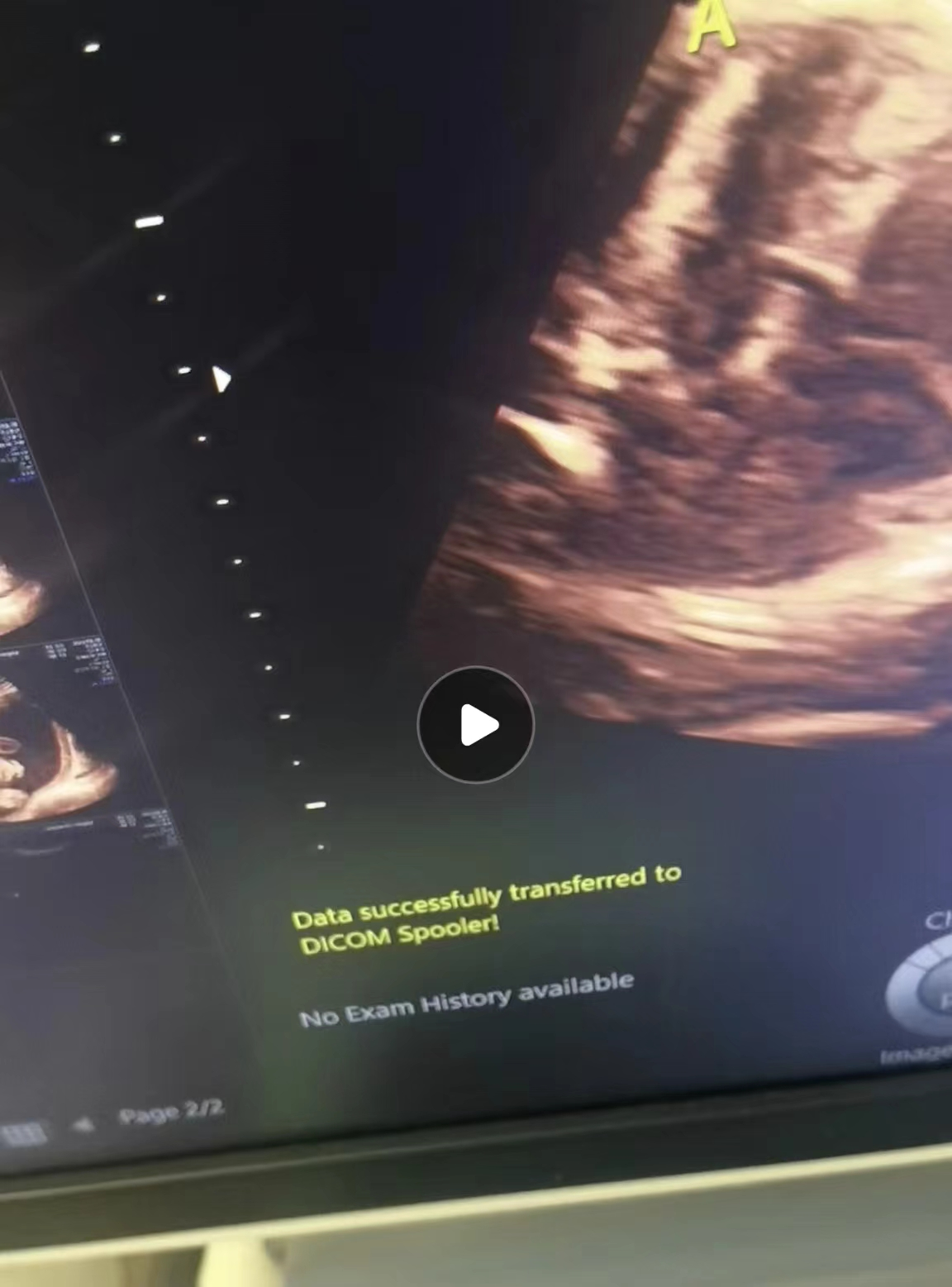 维修GE 彩色多普勒超声诊断仪 VOLUSON E8 经常间歇性无法传图