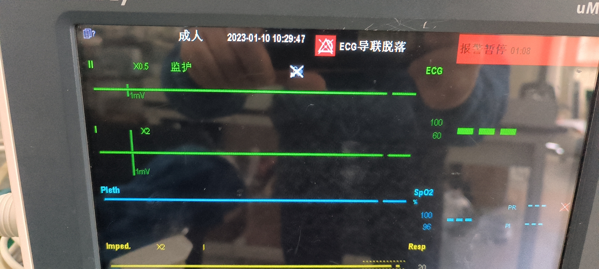 维修迈瑞 监护仪 uMEC10 心电板