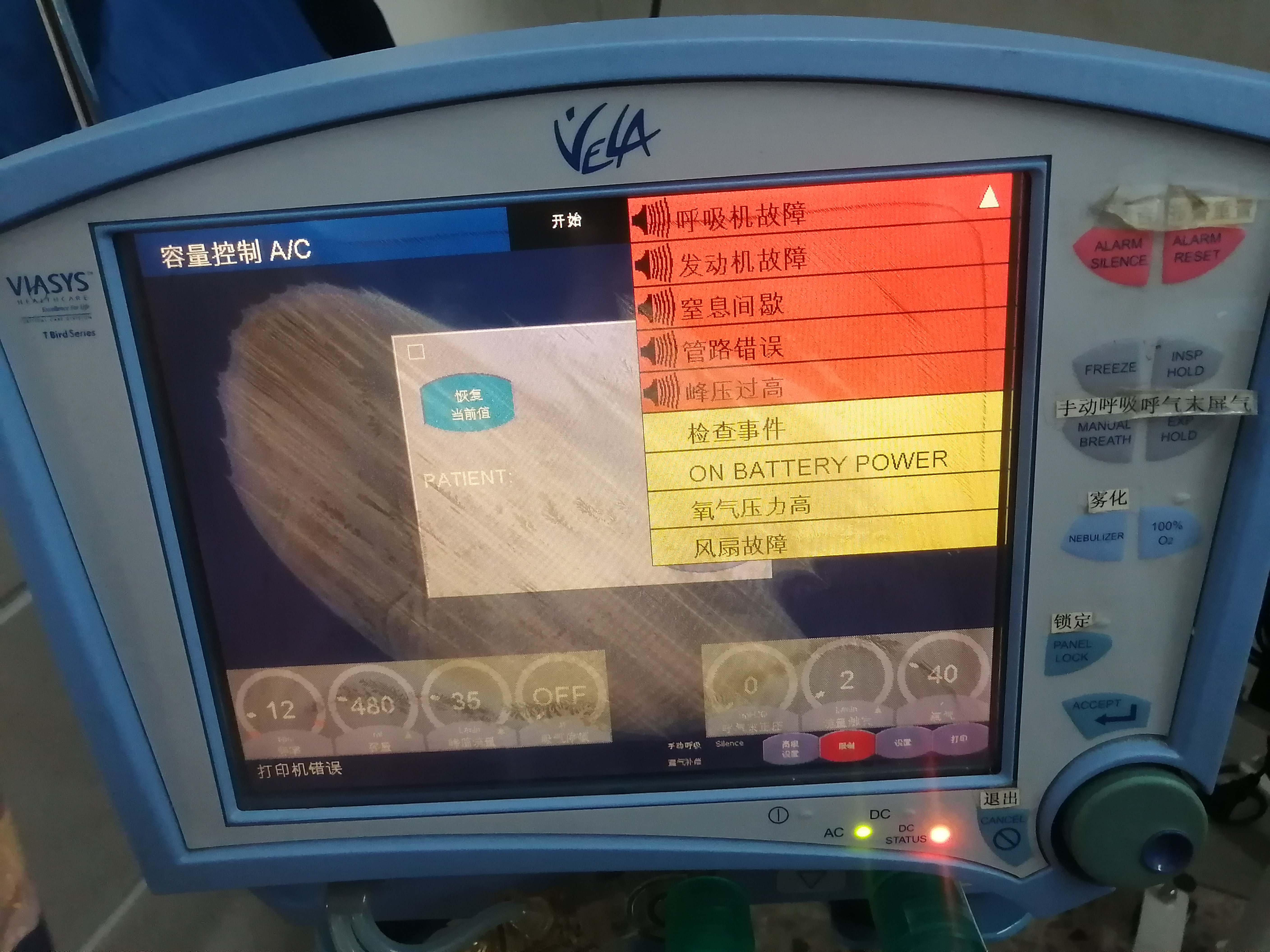 维修康尔福盛 呼吸机 VELA  氧泄露管老化破损，氧浓度极度不准。 